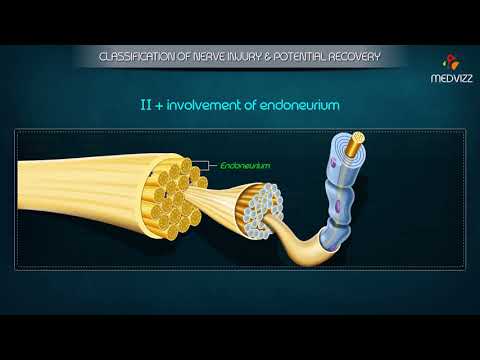 Classification of Peripheral Nerve Injury - Seddon's classification , Sunderland's classification