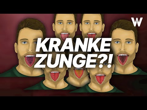 Braune Zunge, Erdbeerzunge, Lackzunge? DAS erfährst du über Deine Gesundheit!