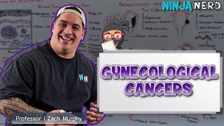 Gynecological Cancers | Clinical Medicine