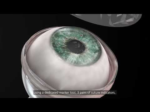 CorNeat KPro animation