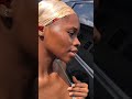 Skin Transformation How I Cleared My Acne Hyperpigmentation Full Video On My Channel