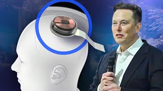 Elon Musk&#39;s Neuralink brain chip demo explained
