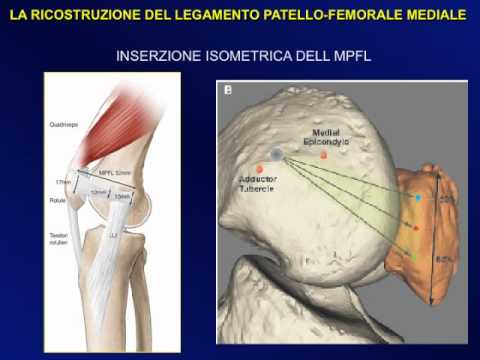Dolori articolari dei grandi rimedi punta popolari La parte inferiore della schiena colonna vertebrale dolore