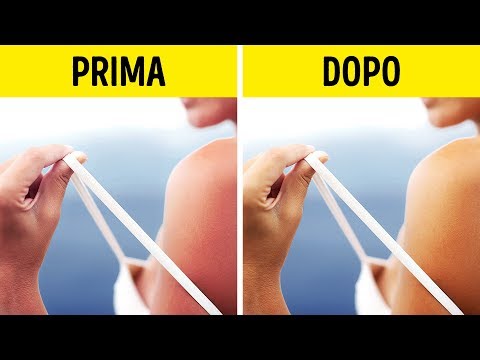 Crema contro pigmentazione Abbronzatura su una faccia macchie scure