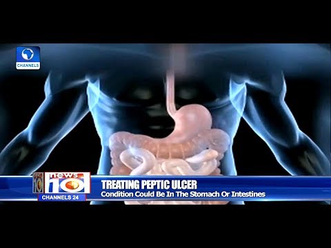 , title : 'How To Treat Peptic Ulcer |Health Focus|'