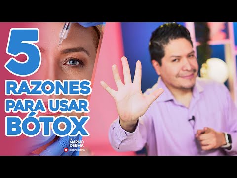 5 RAZONES POR LAS QUE USAR BÓTOX