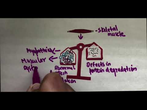 Hanging in the balance: TRIM32 mutations alter protein levels in muscular dystrophy