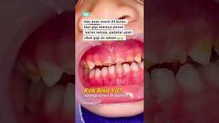 Download lagu 🍼 Gigi Anak Penuh Karies, Kok Bisa? 😢 mp3