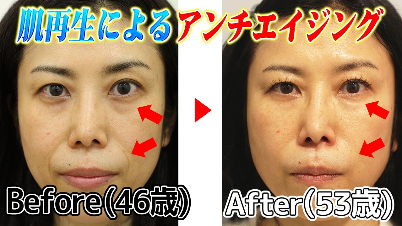 【歳を取らない！？】柴田亜美が通う驚愕のアンチエイジング