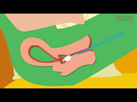 HPV DNA TEST | Get tested Now | DrSafeHands