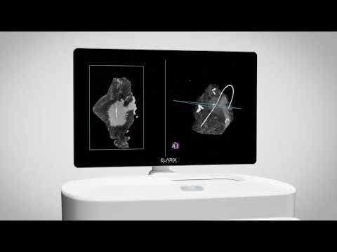 Moodive & Clarix Imaging – Innovation in tumor visualization