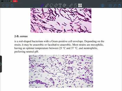 Lec 13 Gram positive bacilli