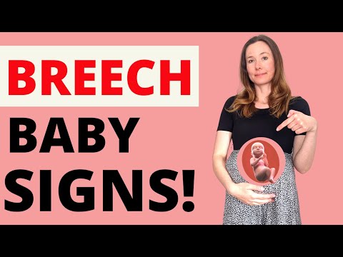 BREECH BABY - BREECH BABY SIGNS - IS MY BABY IN A BREECH POSITION?