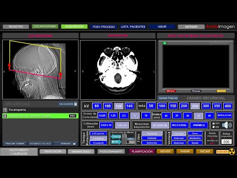 Tutorial Simulador Tomografía Computarizada (TC) Cráneo