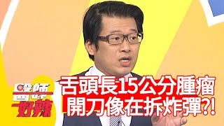 舌頭長15公分腫瘤！開刀像在拆炸彈？！【醫師好辣】20200211 part1 EP891 李偉浩 陳榮堅