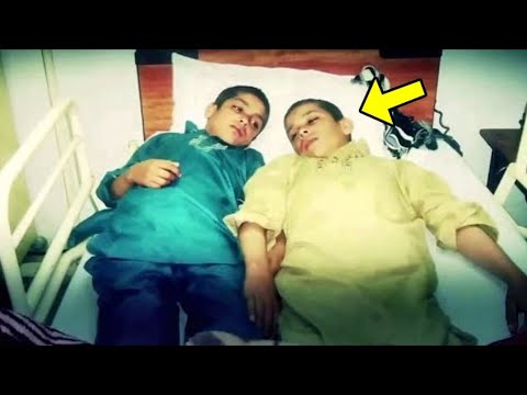 Këta vëllezër janë normalë gjatë ditës por kur dielli perendon ata paralizohen, ja si duken!