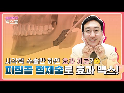 사각턱 수술 효과를 극대화하는 방법! 피질골 절제술로 효과 MAX!