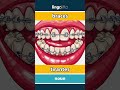braces - tirantes video thumbnail