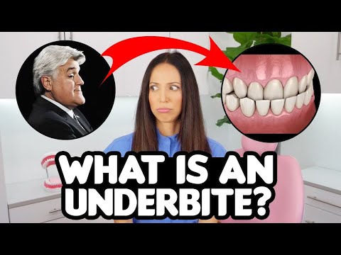 Underbite Correction EXPLAINED (causes & treatments)
