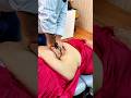 Navel Displacement Treatment Ytshort Feedshort Trend