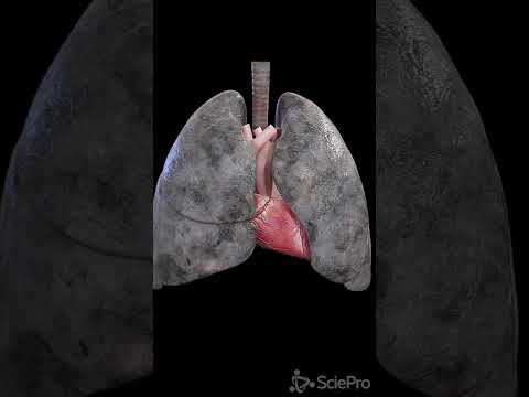 Stop smoking! Anatomy of a smoker´s lung.  #anatomy #meded #3danimation