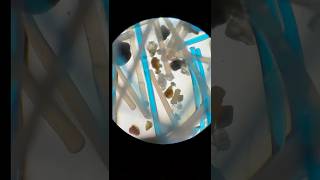 Download lagu What’s Really on Your Toothbrush Under a Microscope? 😱🦠 #microscope #toothbrush #bacteria mp3