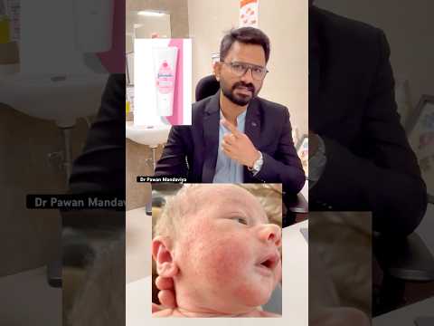 Baby Skin Care: Choosing the Best Baby Cream for Healthy Skin #bestbabyproducts #babyskincare