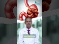 Mkato Wa Mkundu Kwa Watoto Dalili Na Huduma Bila Upasuaji Dr Jeyabaul RA Apollo Hospitals