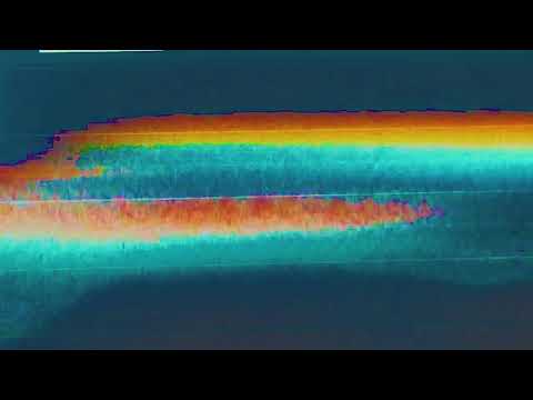 Foa Hoka - Fotosmert