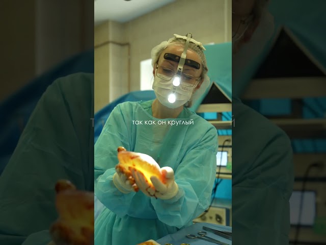 ФОКУС С КРУГЛЫМИ ИМПЛАНТАМИ
