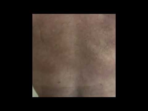 Video thumb