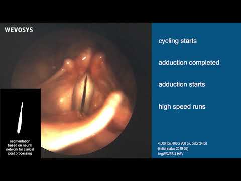 lingWAVES 4 High Speed Video endoscopy (HSV)