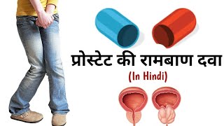 प्रोस्टेट क्या होता है? प्रोस्टेट के लक्षण और उपचार (प्रोस्टेट की रामबाण दवा in hindi)