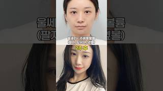 팔자주름이랑 이중턱 한 번에 해결한 조합