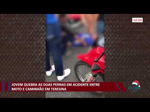 Jovem quebra as duas pernas em acidente entre moto e caminhão em Teresina 18 12 2020