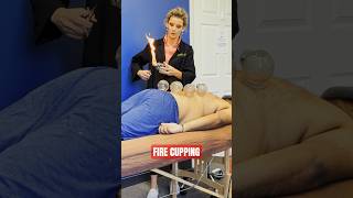 Download lagu Apa itu terapi bekam api? 🔥 mp3