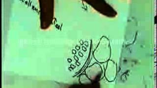 general pathology 31 : DR SAMEH GHAZY benign1