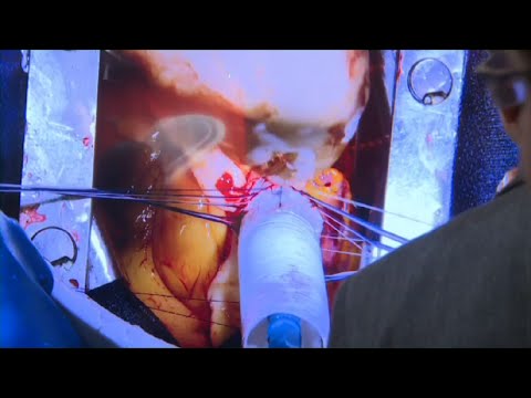 MEDICA 2014: Die Gesundheit und das liebe Geld