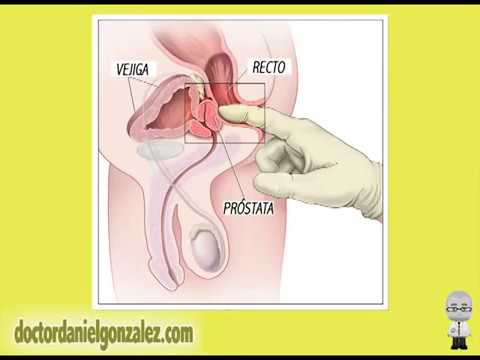 tratament homeopat cancer prostata