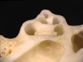 Acland S Video Atlas Of Human Anatomy Cochlea