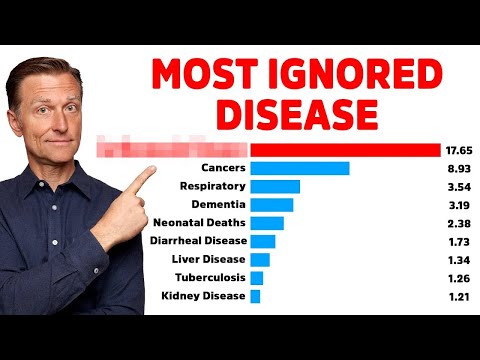 Does Stevia Affect your Blood Sugar – Dr Berg