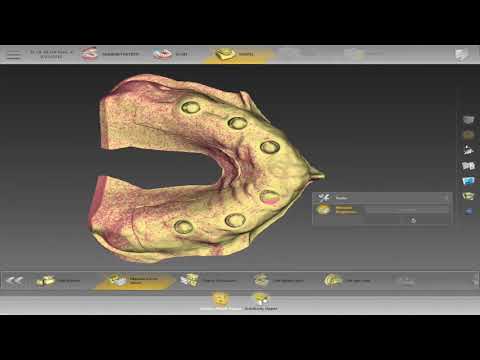 On-Demand Webinar: Harvest TriLor® Screw-retained Full Arch Step-by-step with Frankie Acosta