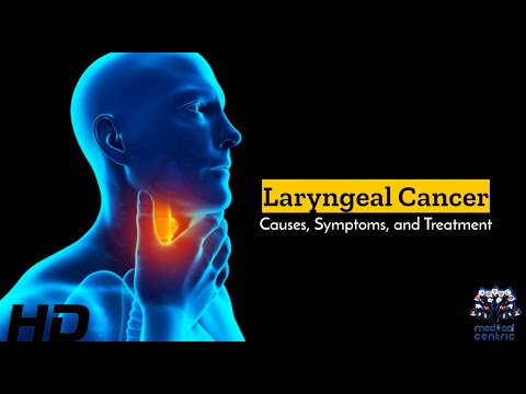Malignant Peripheral Nerve Sheath Tumor Causes Signs and Symptoms Diagnosis and Treatment