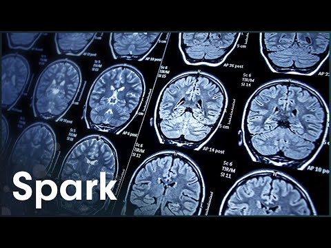 What Happens To The Brain In Old Age?