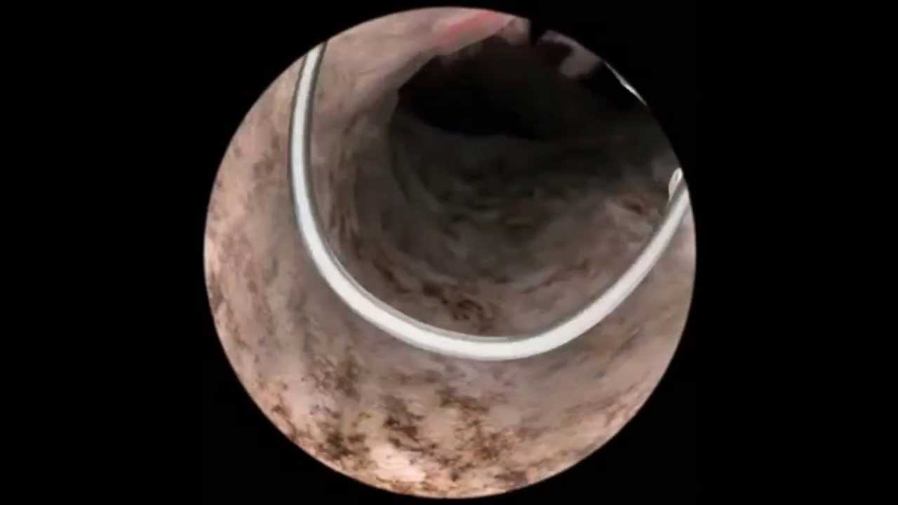 Luis Susanibar Napuri-40