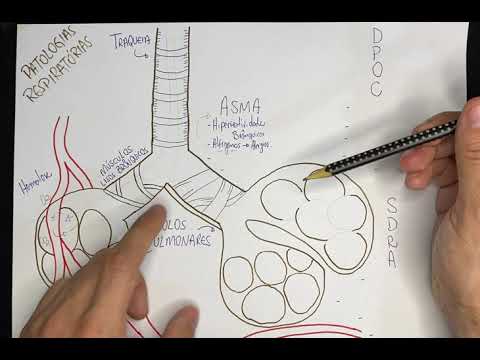 Vídeo-Esquema - Patologias Respiratórias: ASMA, DPOC, SDRA