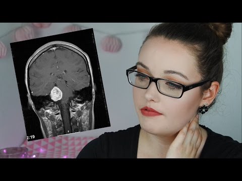 Goff treat Kniegelenk Krankheit Gelenkschwellung auf dem Fuß, was zu tun