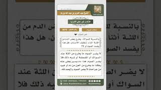 صورة 3876 - حكم صوم من استخدم السواك فخرج من لثته دم - نور على الدرب