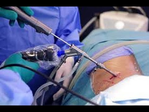 Боль в спине спирает дыхание Диплом лфк при остеохондрозе