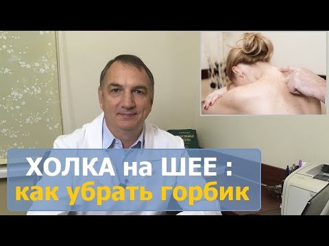 Монастырская мазь здоровые суставы купить в Болят мышцы шеи спереди после
